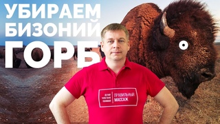 Как убрать бизоний горб
