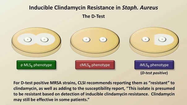 Antibiotic Resistance ( Antibiotics Lecture