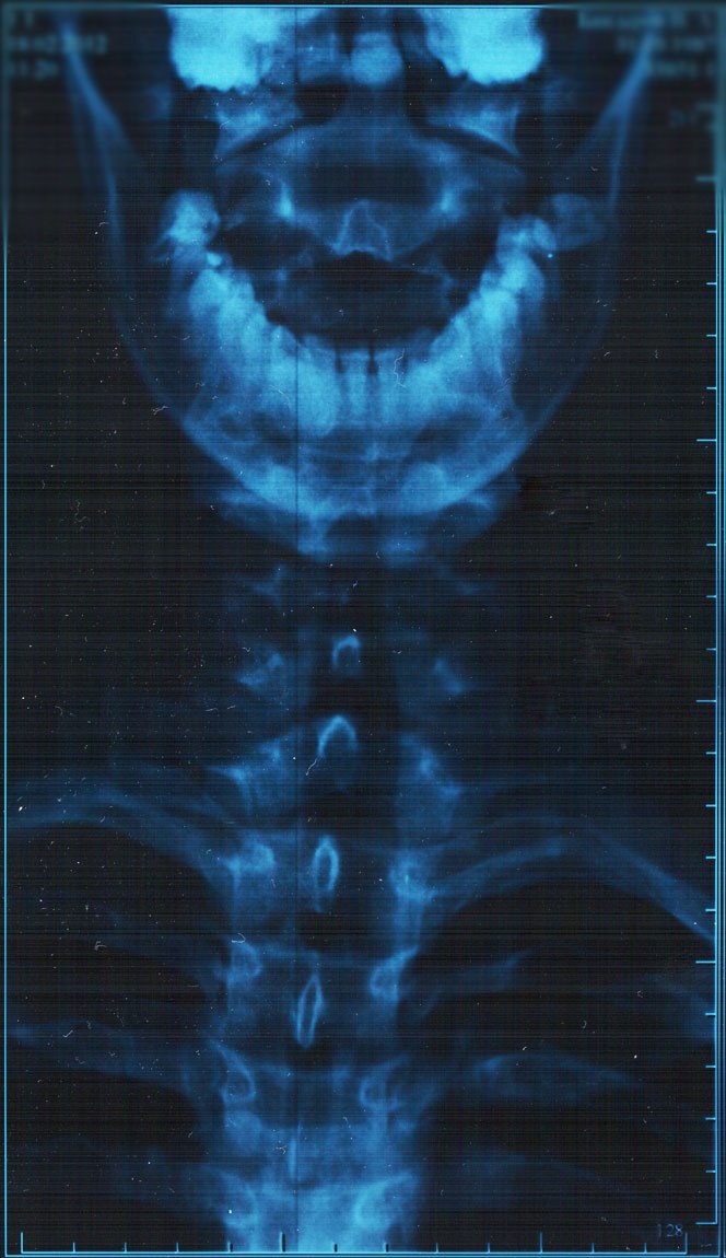 Владимир Бандеров Reloadead | Обнинск
