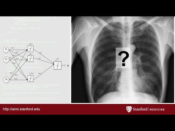 AI in Radiology at Stanford: Rise of the
